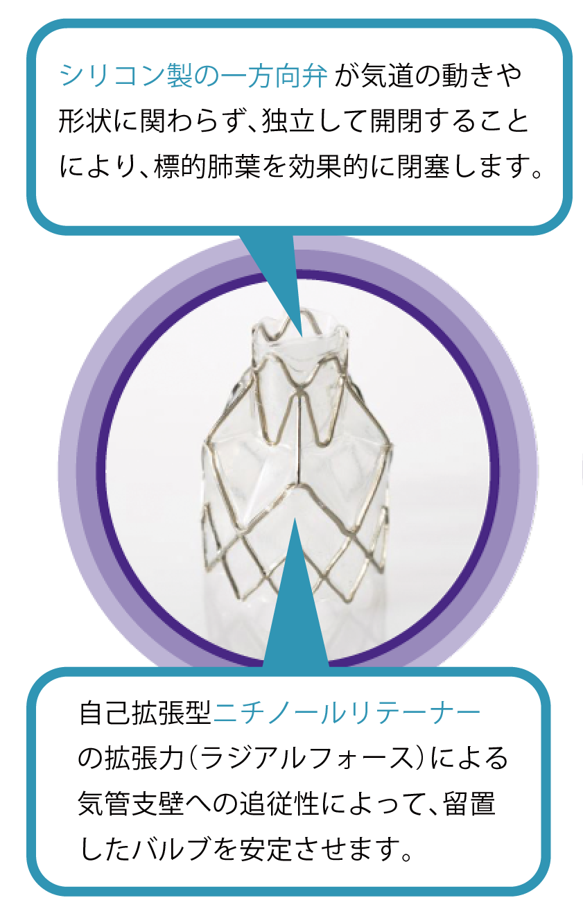 バルブの特長の説明