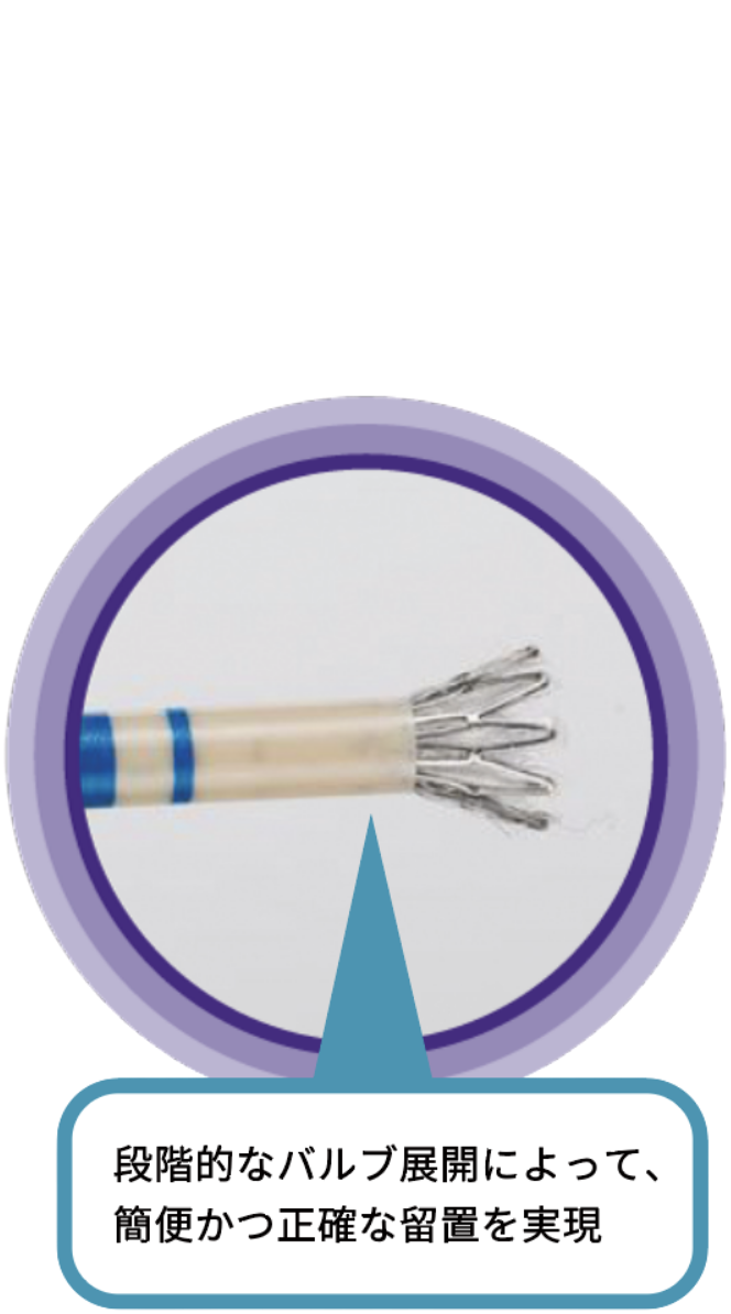 バルブの特長の説明